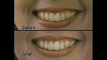 Load image into Gallery viewer, Dr. George&#39;s Dental White Whitening for Two by Dr. George&#39;s