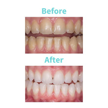 Load image into Gallery viewer, White Dental Beauty Teeth Whitening Syringe Gel Refills; 4 Syringes of 1.2 ml per Pack. Tooth Whitening System Powered by Novon Technology (6% Hydrogen Peroxide)