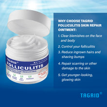 Load image into Gallery viewer, TAGRID Folliculitis