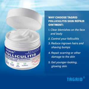 TAGRID Folliculitis