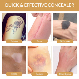 Tattoo Cover Up, Ultra Thin Tattoo Cover Up Patch for Tattoo, Scar, Birthmarks, Waterproof and Sweatproof, 6 Pcs