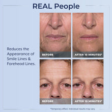 Load image into Gallery viewer, Plexaderm Rapid Reduction Eye Serum - Visibly Reduces Under-Eye Bags, Wrinkles, Dark Circles, Fine Lines &amp; Crow&#39;s Feet Instantly, Anti Aging Wrinkle Remover for Face, 30 Single Use Pods