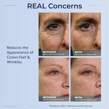 Load image into Gallery viewer, Plexaderm Rapid Reduction Eye Serum - Visibly Reduces Under-Eye Bags, Wrinkles, Dark Circles, Fine Lines &amp; Crow&#39;s Feet Instantly, Anti Aging Wrinkle Remover for Face, 30 Single Use Pods