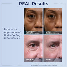 Load image into Gallery viewer, Plexaderm Rapid Reduction Eye Serum - Visibly Reduces Under-Eye Bags, Wrinkles, Dark Circles, Fine Lines &amp; Crow&#39;s Feet Instantly, Anti Aging Wrinkle Remover for Face, 30 Single Use Pods
