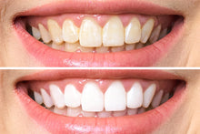 Load image into Gallery viewer, Dr. George&#39;s Dental White Whitening for Two by Dr. George&#39;s