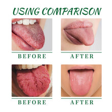 Load image into Gallery viewer, 2PCS EELHOE Tongue Repair Spray – Relieves Dryness, Swelling, and White Coating, Promotes Oral Health, Portable Pain Relief Spray