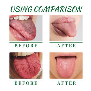 2PCS EELHOE Tongue Repair Spray – Relieves Dryness, Swelling, and White Coating, Promotes Oral Health, Portable Pain Relief Spray